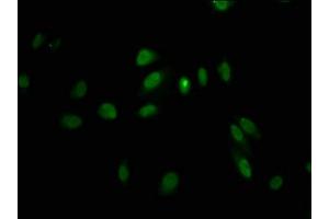 Immunofluorescence staining of Hela cells with ABIN7158383 at 1:100, counter-stained with DAPI. (LHX2 Antikörper  (AA 197-377))