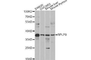 Western blot analysis of extracts of various cell lines, using RPLP0 antibody (ABIN6290910) at 1:1000 dilution. (RPLP0 Antikörper)