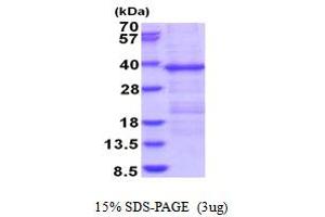 SDS-PAGE (SDS) image for Homocysteine-Inducible, Endoplasmic Reticulum Stress-Inducible, Ubiquitin-Like Domain Member 1 (HERPUD1) (AA 1-263) protein (His tag) (ABIN5853928)