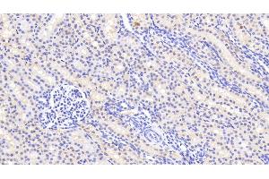 Detection of AGMAT in Human Kidney Tissue using Polyclonal Antibody to Agmatine Ureohydrolase (AGMAT) (AGMAT Antikörper  (AA 53-151))