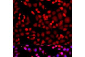 Immunofluorescence analysis of A549 cells using MTUS1 Polyclonal Antibody