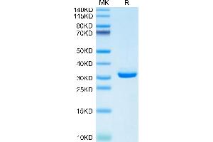 APOE Protein (AA 19-311) (His tag)