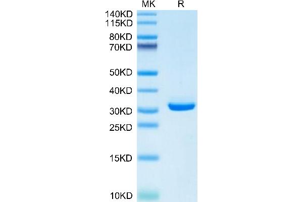 APOE Protein (AA 19-311) (His tag)