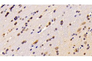 Detection of RGS6 in Rat Cerebrum Tissue using Polyclonal Antibody to Regulator Of G Protein Signaling 6 (RGS6) (RGS6 Antikörper  (AA 1-472))