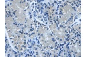DAB staining on IHC-P; Samples: Human Stomach Tissue (TGFBI Antikörper  (AA 423-632))