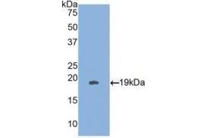 Detection of Recombinant HSPb3, Human using Polyclonal Antibody to Heat Shock Protein Beta 3 (HSPb3) (HSPB3 Antikörper  (AA 1-150))