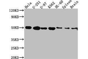 Western Blot Positive WB detected in: Hela whole cell lysate, U-251 whole cell lysate, U-87 whole cell lysate, K562 whole cell lysate, HL-60 whole cell lysate, Rat Spleen whole cell lysate, Rat Brain whole cell lysate All lanes: Dopamine Receptor D3 antibody at 1:1000 Secondary Goat polyclonal to rabbit IgG at 1/50000 dilution Predicted band size: 45, 41 kDa Observed band size: 50 kDa (Rekombinanter DRD3 Antikörper)