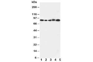 Western blot testing of CD18 antibody and Lane 1:  Jurkat cell lysate