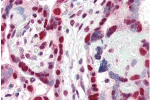 Human Placenta (formalin-fixed, paraffin-embedded) stained with CBX3 antibody ABIN337123 at 2. (CBX3 Antikörper  (AA 74-87))