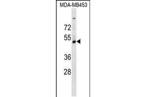 Western blot analysis in MDA-MB453 cell line lysates (35ug/lane). (SERPINI2 Antikörper  (C-Term))