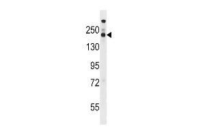Western blot analysis in WiDr cell line lysates (35ug/lane).