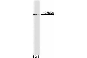Western blot analysis of DLC-1 on a SK-Hep-1 (human liver adenocarcinoma) lysate. (DLC1 Antikörper  (AA 47-249))