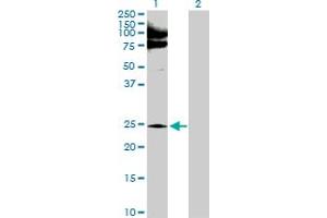 Western Blot analysis of NQO2 expression in transfected 293T cell line by NQO2 MaxPab polyclonal antibody. (NQO2 Antikörper  (AA 1-231))