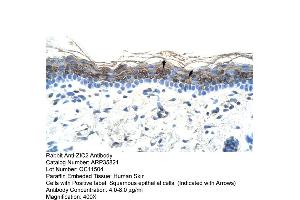 Human Skin (ZIC2 Antikörper  (C-Term))