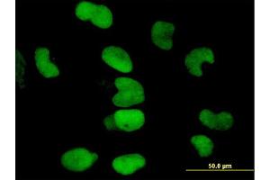 Immunofluorescence of monoclonal antibody to TRIM28 on HeLa cell. (KAP1 Antikörper  (AA 379-524))