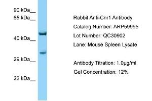 Western Blotting (WB) image for anti-Cannabinoid Receptor 1 (CNR1) (C-Term) antibody (ABIN970424) (CNR1 Antikörper  (C-Term))