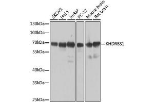 Western blot analysis of extracts of various cell lines, using KHDRBS1 antibody. (KHDRBS1 Antikörper)