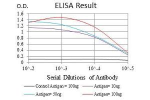 Black line: Control Antigen (100 ng), Purple line: Antigen(10 ng), Blue line: Antigen (50 ng), Red line: Antigen (100 ng), (KCNQ1 Antikörper)