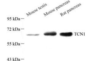 Western blot analysis of TCN1 (ABIN7075950),at dilution of 1: 800 (TCN1 Antikörper)