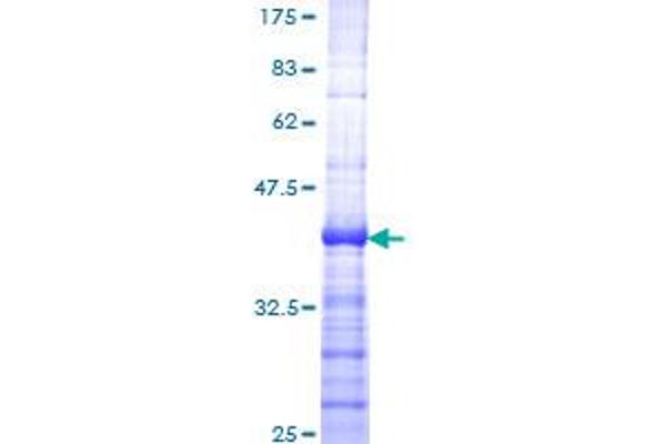 Menin Protein (AA 506-615) (GST tag)