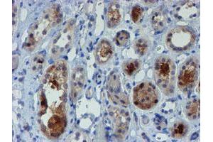 Immunohistochemical staining of paraffin-embedded Human Kidney tissue using anti-MPI mouse monoclonal antibody. (MPI Antikörper)
