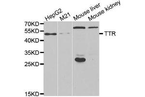 Western Blotting (WB) image for anti-Transthyretin (TTR) antibody (ABIN3017544)