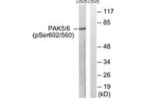 Western blot analysis of extracts from LOVO cells treated with PMA 125ng/ml 30', using PAK5/6 (Phospho-Ser602/Ser560) Antibody. (PAK5/6 (AA 566-615), (pSer602) Antikörper)