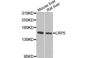 Western blot analysis of extracts of various tissues, using LRP5 antibody. (LRP5 Antikörper  (AA 1000-1250))
