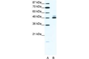 Western Blotting (WB) image for anti-Cholinergic Receptor, Nicotinic, beta 2 (Neuronal) (CHRNB2) antibody (ABIN2463733) (CHRNB2 Antikörper)