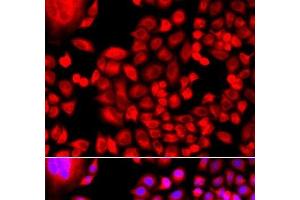 Immunofluorescence analysis of A549 cells using MTHFD1L Polyclonal Antibody