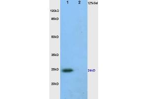 L1 human colon carcinoma, L2 rat heart lysates probed (ABIN872390) at 1:200 in 4 °C. (VEGFA Antikörper  (AA 81-132))