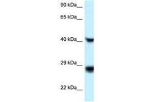 Image no. 1 for anti-Ras-Like Without CAAX 1 (RIT1) (C-Term) antibody (ABIN6747636) (RIT1 Antikörper  (C-Term))