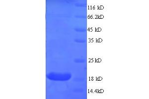SDS-PAGE (SDS) image for Myosin, Light Chain 2, Regulatory, Cardiac, Slow (MYL2) (AA 8-164), (partial) protein (His tag) (ABIN5712716)