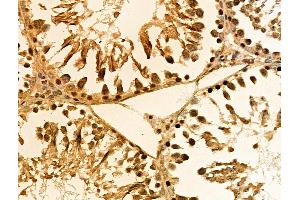ABIN6257940 and ABIN6274488 at 1/100 staining Rat testis tissue by IHC-P.