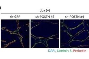 Immunofluorescence (Paraffin-embedded Sections) (IF (p)) image for anti-Periostin (POSTN) (C-Term) antibody (ABIN2854805)
