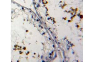 IHC-P analysis of testis tissue, with DAB staining. (NUP62 Antikörper  (AA 186-432))