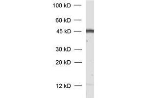 dilution: 1 : 1000, sample: rat brain homogenate (GAP43 Antikörper)