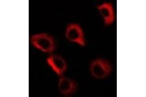 Immunofluorescent analysis of GP73 staining in MCF7 cells. (GOLM1 Antikörper)