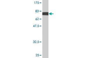 Western Blot detection against Immunogen (75. (PIK3R1 Antikörper  (AA 1-454))