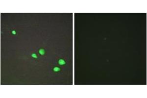 Immunofluorescence (IF) image for anti-Chromodomain Helicase DNA Binding Protein 4 (CHD4) (AA 571-620) antibody (ABIN2889596)