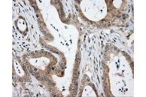Immunohistochemical staining of paraffin-embedded Kidney tissue using anti-HDAC10 mouse monoclonal antibody. (HDAC10 Antikörper)