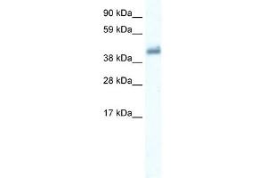 WB Suggested Anti-GABRE Antibody Titration:  0. (GABRE Antikörper  (Middle Region))