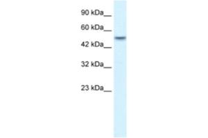 Western Blotting (WB) image for anti-Ankyrin Repeat Domain 11 (ANKRD11) antibody (ABIN2460748)