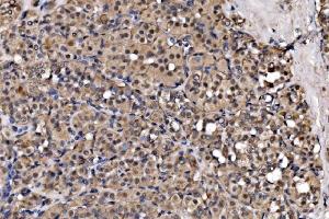 IHC analysis of EXOSC3 using anti-EXOSC3 antibody (ABIN7602216). (EXOSC3 Antikörper  (AA 64-275))