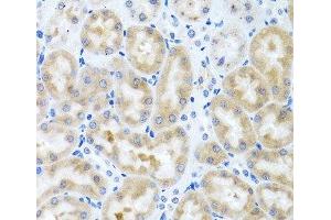 Immunohistochemistry of paraffin-embedded Rat kidney using INHBC Polyclonal Antibody at dilution of 1:100 (40x lens).