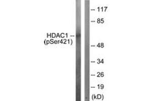 Western blot analysis of extracts from Jurkat cells treated with EGF 200ng/ml 30', using HDAC1 (Phospho-Ser421) Antibody. (HDAC1 Antikörper  (pSer421))