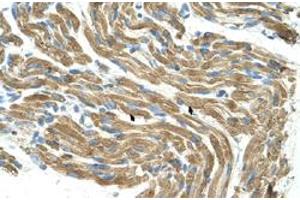 Immunohistochemical staining (Formalin-fixed paraffin-embedded sections) of human muscle with HAL polyclonal antibody  at 4-8 ug/mL working concentration. (HAL Antikörper  (C-Term))