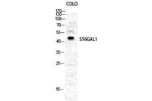 Western Blotting (WB) image for anti-ST6 beta-Galactosamide alpha-2,6-Sialyltranferase 1 (ST6GAL1) (Internal Region) antibody (ABIN3179929) (ST6GAL1 Antikörper  (Internal Region))