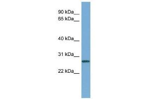 Western Blot showing CCNDBP1 antibody used at a concentration of 1-2 ug/ml to detect its target protein. (CCNDBP1 Antikörper  (Middle Region))