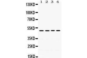Western Blotting (WB) image for anti-Damage-Specific DNA Binding Protein 2, 48kDa (DDB2) (AA 1-115) antibody (ABIN3043488) (DDB2 Antikörper  (AA 1-115))